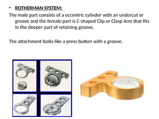 • ROTHERMAN SYSTEM:
The male part consists of a eccentric cylinder with an undercut or
groove and the female part is C-shaped Clip or Clasp Arm that fits
in the deeper part of retaining groove.
The attachment looks like a press button with a groove.
 