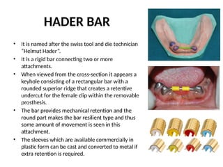 HADER BAR
• It is named after the swiss tool and die technician
“Helmut Hader”.
• It is a rigid bar connecting two or more
attachments.
• When viewed from the cross-section it appears a
keyhole consisting of a rectangular bar with a
rounded superior ridge that creates a retentive
undercut for the female clip within the removable
prosthesis.
• The bar provides mechanical retention and the
round part makes the bar resilient type and thus
some amount of movement is seen in this
attachment.
• The sleeves which are available commercially in
plastic form can be cast and converted to metal if
extra retention is required.
 