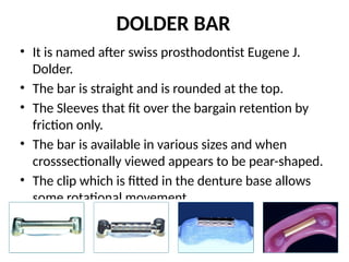DOLDER BAR
• It is named after swiss prosthodontist Eugene J.
Dolder.
• The bar is straight and is rounded at the top.
• The Sleeves that fit over the bargain retention by
friction only.
• The bar is available in various sizes and when
crosssectionally viewed appears to be pear-shaped.
• The clip which is fitted in the denture base allows
some rotational movement.
• It is available in sizes in diameter of 1.6 and 2.2
mm.
 