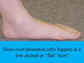high arch overpronation