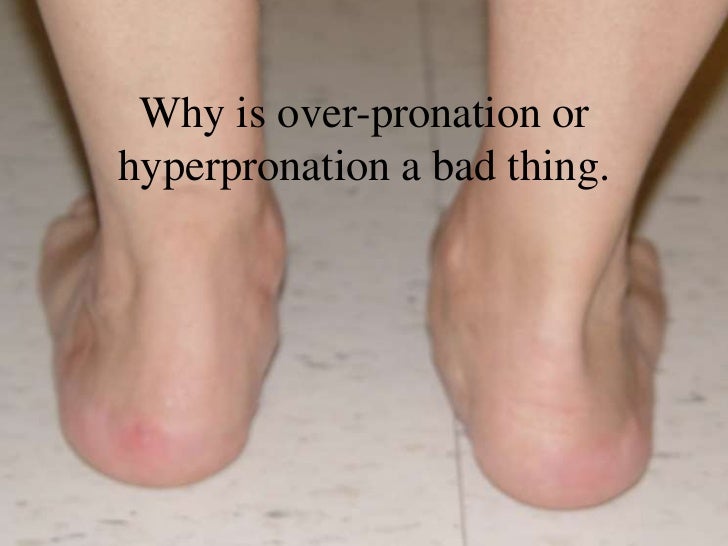 hyper pronation