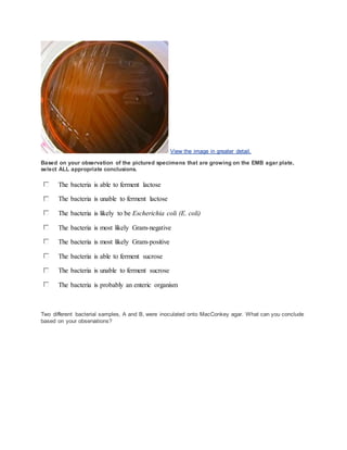 View the image in greater detail.
Based on your observation of the pictured specimens that are growing on the EMB agar plate,
select ALL appropriate conclusions.
The bacteria is able to ferment lactose
The bacteria is unable to ferment lactose
The bacteria is likely to be Escherichia coli (E. coli)
The bacteria is most likely Gram-negative
The bacteria is most likely Gram-positive
The bacteria is able to ferment sucrose
The bacteria is unable to ferment sucrose
The bacteria is probably an enteric organism
Two different bacterial samples, A and B, were inoculated onto MacConkey agar. What can you conclude
based on your observations?
 