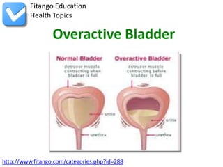 Fitango Education
          Health Topics

                  Overactive Bladder




http://www.fitango.com/categories.php?id=288
 