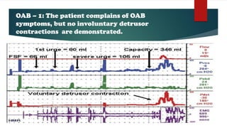 OAB – 1: The patient complains of OAB
symptoms, but no involuntary detrusor
contractions are demonstrated.
 