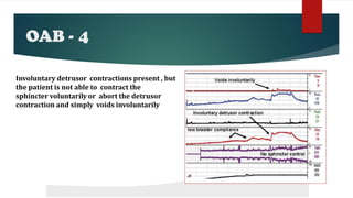 OAB - 4
Involuntary detrusor contractions present , but
the patient is not able to contract the
sphincter voluntarily or abort the detrusor
contraction and simply voids involuntarily
 