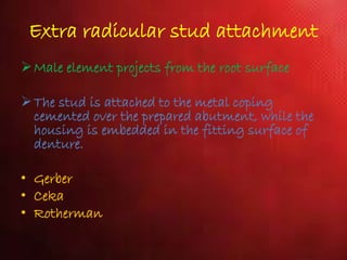 Extra radicular stud attachment
Male element projects from the root surface
The stud is attached to the metal coping
cemented over the prepared abutment, while the
housing is embedded in the fitting surface of
denture.
• Gerber
• Ceka
• Rotherman
 