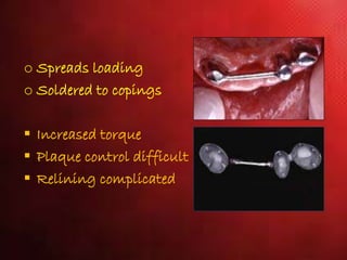 o Spreads loading
o Soldered to copings
 Increased torque
 Plaque control difficult
 Relining complicated
 