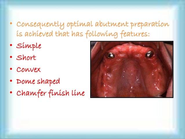overdenture