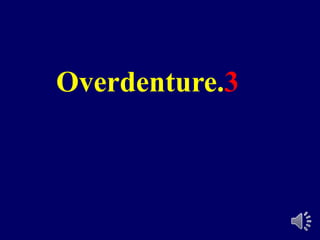 Overdenture.3
 