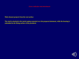 Extra radicular stud attachment
Male element projects from the root surface
The stud is attached to the metal coping cemented over the prepared abutment, while the housing is
embedded in the fitting surface of the prosthesis
 