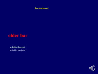Bar attachments
older bar
a- Dolder bar unit.
b- Dolder bar joint
 