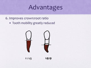 Advantages
6. Improves crown:root ratio
• Tooth mobility greatly reduced
1 : 1.5 1.5 : 1
1 : 9
 