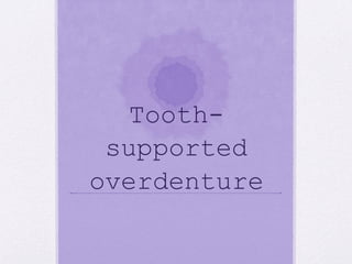 Tooth-
supported
overdenture
 