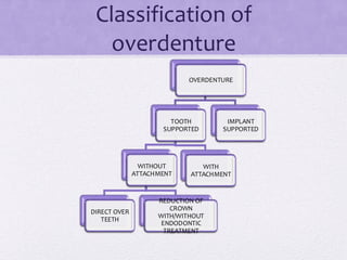 Classification of
overdenture
OVERDENTURE
TOOTH
SUPPORTED
WITHOUT
ATTACHMENT
DIRECT OVER
TEETH
REDUCTION OF
CROWN
WITH/WITHOUT
ENDODONTIC
TREATMENT
WITH
ATTACHMENT
IMPLANT
SUPPORTED
 