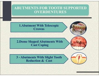 ABUTMENTS FOR TOOTH SUPPORTED
OVERDENTURES
1.Abutment With Telescopic
Crowns
2.Dome Shaped Abutments With
Cast Coping
3 - Abutments With Slight Tooth
Reduction & Cast
 