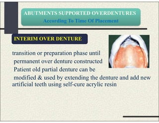 ABUTMENTS SUPPORTED OVERDENTURES
According To Time Of Placement
transition or preparation phase until
permanent over denture constructed
Patient old partial denture can be
modified & used by extending the denture and add new
artificial teeth using self-cure acrylic resin
INTERIM OVER DENTURE
 