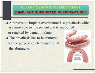 CLASSIFICATION OF OVERDENTURES
2-IMPLANT SUPPORTED OVERDENTURES
 A removable implant overdenture is a prosthesis which
is removable by the patient and is supported
or retained by dental implants
 The prosthesis has to be removed
for the purpose of cleaning around
the abutments
 