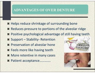 ADVANTAGES OF OVER DENTURE
Helps reduce shrinkage of surrounding bone
Reduces pressure to portions of the alveolar ridge
Positive psychological advantage of still having teeth
Support – Stability- Retention
Preservation of alveolar hone
Feels more like having teeth
More retentive in many cases
Patient acceptance………….
 