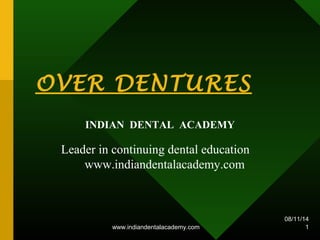 OVER DENTURES
INDIAN DENTAL ACADEMY
Leader in continuing dental education
www.indiandentalacademy.com
06/15/15
1www.indiandentalacademy.com
 
