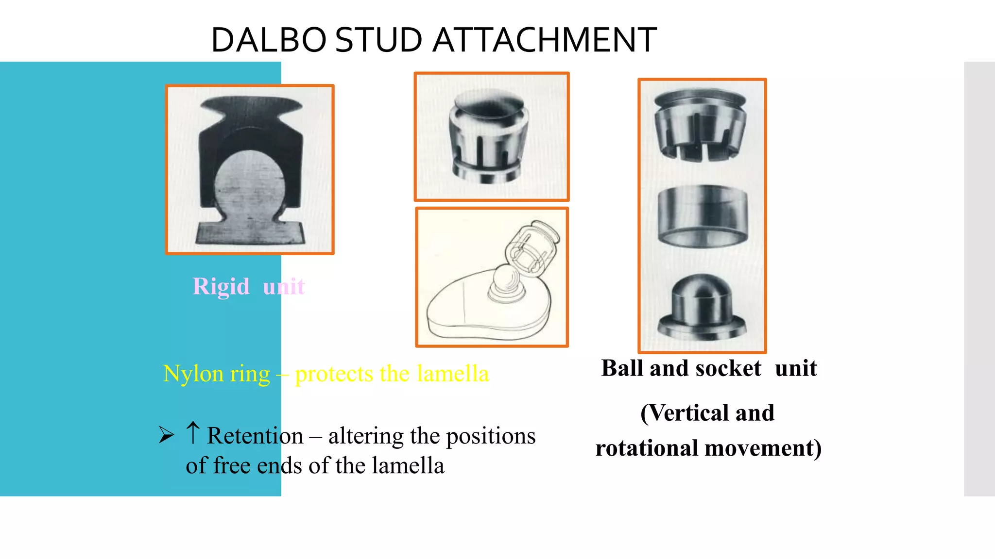 TOOTH SUPPORTED OVERDENTURES | PPTX
