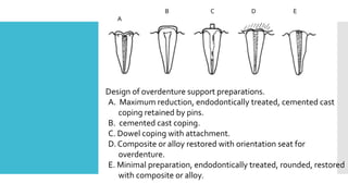 Design of overdenture support preparations.
A. Maximum reduction, endodontically treated, cemented cast
coping retained by pins.
B. cemented cast coping.
C. Dowel coping with attachment.
D. Composite or alloy restored with orientation seat for
overdenture.
E. Minimal preparation, endodontically treated, rounded, restored
with composite or alloy.
A
B C D E
 