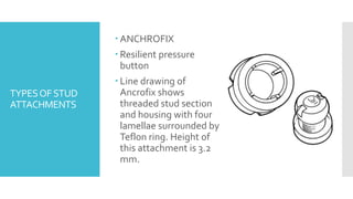 TOOTH SUPPORTED OVERDENTURES | PPTX