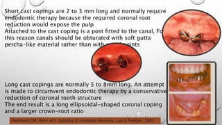Ast Coping Tooth Overdentures | PPTX