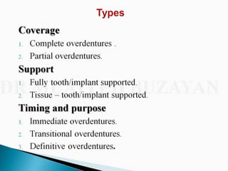 Overdentures and attachments part 1