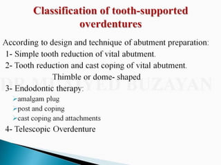 Overdentures and attachments part 1