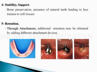 Overdentures and attachments part 1