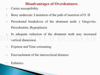 Overdentures and attachments part 1