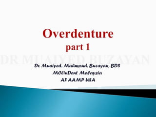 Overdentures and attachments part 1