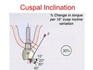 Cuspal Protection OverdenturesandImplants-Handoutpresent.ppt