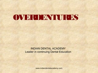 OVERDENTURES
INDIAN DENTAL ACADEMY
Leader in continuing Dental Education
www.indiandentalacademy.com
 