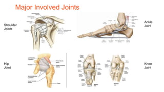Major Involved Joints
Shoulder
Joints
Hip
Joint
Ankle
Joint
Knee
Joint
 