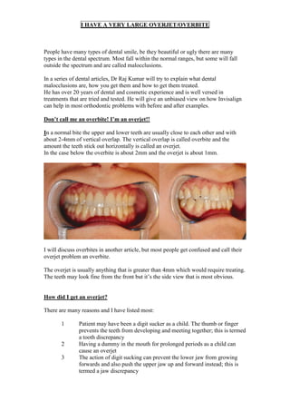 I HAVE A VERY LARGE OVERJET/OVERBITE



People have many types of dental smile, be they beautiful or ugly there are many
types in the dental spectrum. Most fall within the normal ranges, but some will fall
outside the spectrum and are called malocclusions.

In a series of dental articles, Dr Raj Kumar will try to explain what dental
malocclusions are, how you get them and how to get them treated.
He has over 20 years of dental and cosmetic experience and is well versed in
treatments that are tried and tested. He will give an unbiased view on how Invisalign
can help in most orthodontic problems with before and after examples.

Don’t call me an overbite! I’m an overjet!!

In a normal bite the upper and lower teeth are usually close to each other and with
about 2-4mm of vertical overlap. The vertical overlap is called overbite and the
amount the teeth stick out horizontally is called an overjet.
In the case below the overbite is about 2mm and the overjet is about 1mm.




I will discuss overbites in another article, but most people get confused and call their
overjet problem an overbite.

The overjet is usually anything that is greater than 4mm which would require treating.
The teeth may look fine from the front but it’s the side view that is most obvious.


How did I get an overjet?

There are many reasons and I have listed most:

       1       Patient may have been a digit sucker as a child. The thumb or finger
               prevents the teeth from developing and meeting together; this is termed
               a tooth discrepancy
       2       Having a dummy in the mouth for prolonged periods as a child can
               cause an overjet
       3       The action of digit sucking can prevent the lower jaw from growing
               forwards and also push the upper jaw up and forward instead; this is
               termed a jaw discrepancy
 