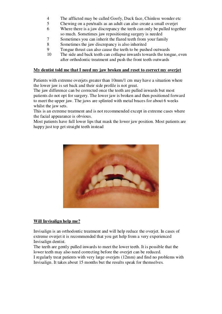 overjet overbite chinless