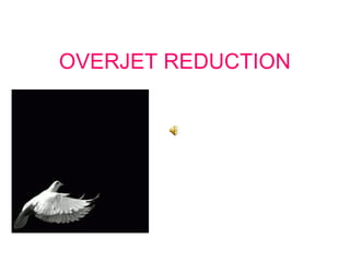 OVERJET REDUCTION 
 