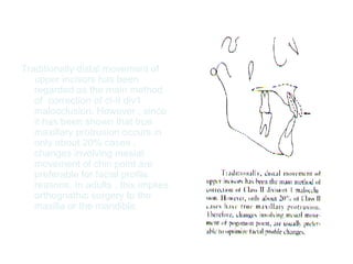 Traditionally distal movement of 
upper incisors has been 
regarded as the main method 
of correction of cl-II div1 
malocclusion. However , since 
it has been shown that true 
maxillary protrusion occurs in 
only about 20% cases , 
changes involving mesial 
movement of chin point are 
preferable for facial profile 
reasons. In adults , this implies 
orthognathic surgery to the 
maxilla or the mandible. 
 