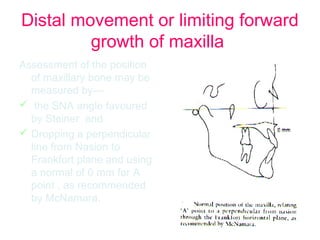 Distal movement or limiting forward 
growth of maxilla 
Assessment of the position 
of maxillary bone may be 
measured by--- 
 the SNA angle favoured 
by Steiner and 
 Dropping a perpendicular 
line from Nasion to 
Frankfort plane and using 
a normal of 0 mm for A 
point , as recommended 
by McNamara. 
 