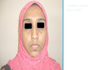 PT NAME: FATEMA 
AGE: 24 YRS 
 