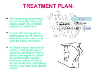 TREATMENT PLAN: 
 The remaining space should 
not be closed by reciprocal 
space closure as Cl-I molar 
relationship will be lost. 
 Excess 10° tipping can be 
corrected by round wire first , 
then rectangular wire can be 
used for bodily movement. 
 If a large overjet needs to be 
closed , rectangular wire is 
essential and support from a 
sleeping headgear or palatal 
bar will definitely needed, 
otherwise molars will come 
forward and molar relationship 
will lost.Also force level should 
be low. 
7 mm 
7 mm 
 