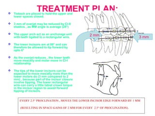 TREATMENT PLAN:  Tieback are placed to hold the upper and 
lower spaces closed. 
 3 mm of overjet may be reduced by Cl-II 
elastics , as MM angle is average (28°) 
 The upper arch act as an anchorage unit 
with teeth ligated to a rectangular wire. 
 The lower incisors are at 89° and can 
therefore be allowed to tip forward by 
upto 6° 
 As the overjet reduces , the lower teeth 
move mesially and molar move in Cl-I 
relationship 
 The tips of the lower incisors can be 
expected to move mesially more than the 
lower molars do (3 mm compared to 2 
mm) , because part of the incisor closure 
involve tipping. The lower rectangular 
wire can carry a little labial crown torque 
in the incisor region to assist forward 
tipping of incisors. 
2 mm 3 mm 
EVERY 2.5° PROCLINATION , MOVES THE LOWER INCISOR EDGE FORWARD BY 1 MM 
(RESULTING IN SPACE GAINS OF 2 MM FOR EVERY 2.5° OF PROCLINATION). 
 