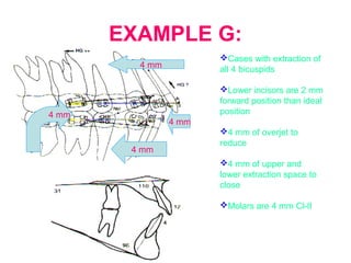 EXAMPLE G: 
Cases with extraction of 
all 4 bicuspids 
Lower incisors are 2 mm 
forward position than ideal 
position 
4 mm of overjet to 
reduce 
4 mm of upper and 
lower extraction space to 
close 
Molars are 4 mm Cl-II 
4 mm 
4 mm 
4 mm 
4 mm 
 