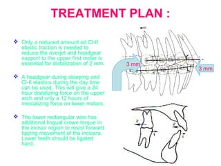 TREATMENT PLAN : 
 Only a reduced amount od Cl-II 
elastic traction is needed to 
reduce the overjet and headgear 
support to the upper first molar is 
essential for distalization of 2 mm. 
 A headgear during sleeping and 
Cl-II elastics during the day time 
can be used. This will give a 24 
hour distalizing force on the upper 
arch and only a 12 hours of 
mesializing force on lower molars. 
 The lower rectangular wire has 
additional lingual crown torque in 
the incisor region to resist forward 
tipping movement of the incisors. 
Lower teeth should be ligated 
hard. 
3 mm 
3 mm 
 
