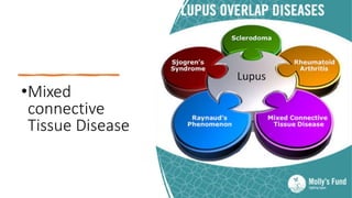 •Mixed
connective
Tissue Disease
 