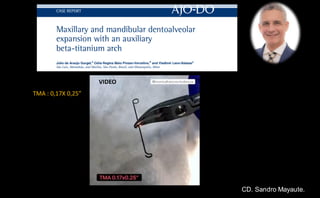 TMA : 0,17X 0,25”
VIDEO
CD. Sandro Mayaute.
 