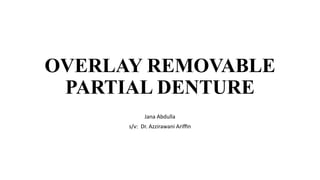 Overlay Temporary Denture Overlay Removable Partial Dentures in Prosthodontics | PPTX