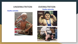 Xaalka aduunka
Xaalka somalia
 