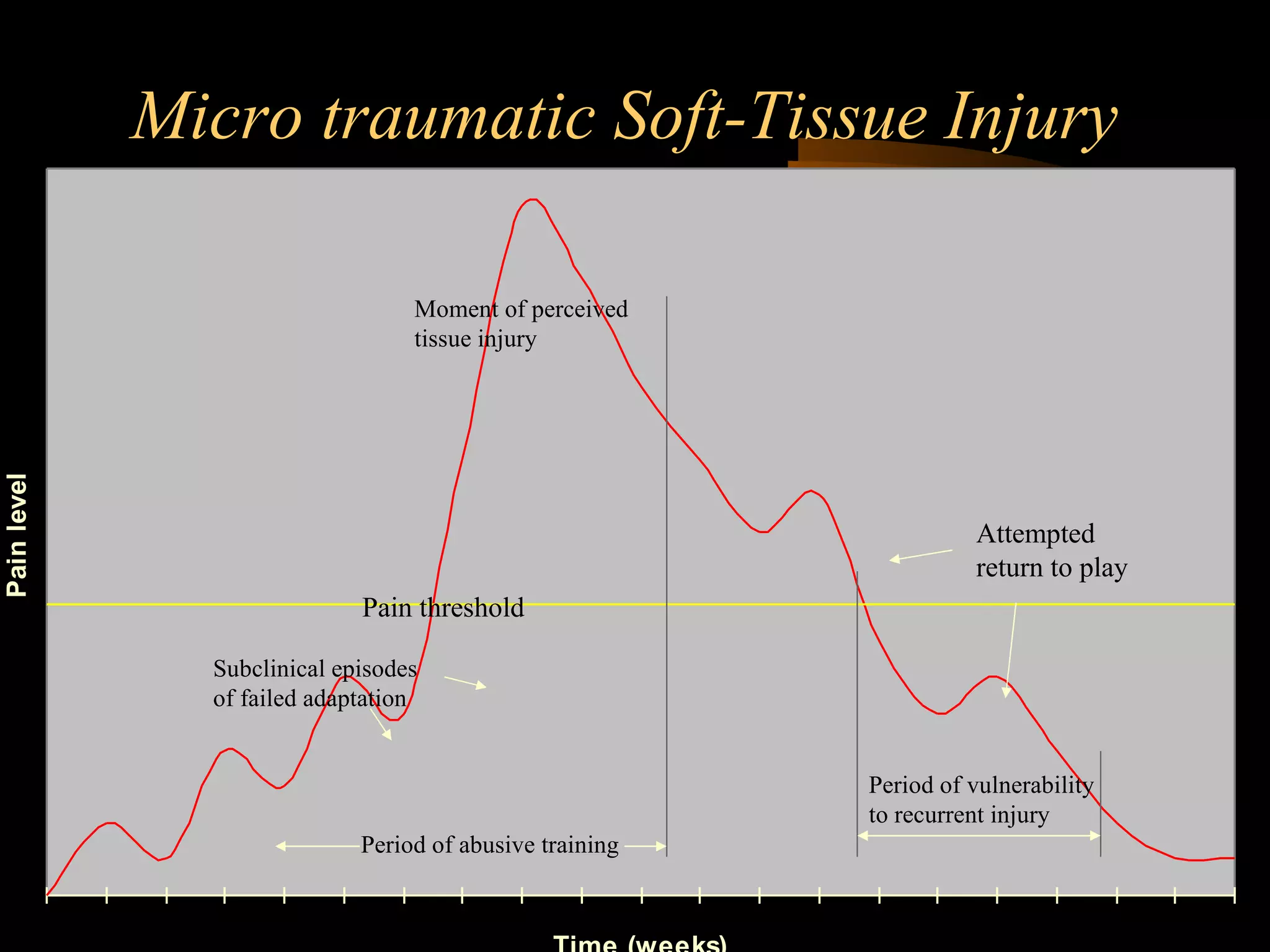 Micro traumatic Soft-Tissue Injury Period of abusive training Subclinical episodes  of failed adaptation Moment of perceived tissue injury Attempted  return to play Period of vulnerability to recurrent injury Pain threshold 